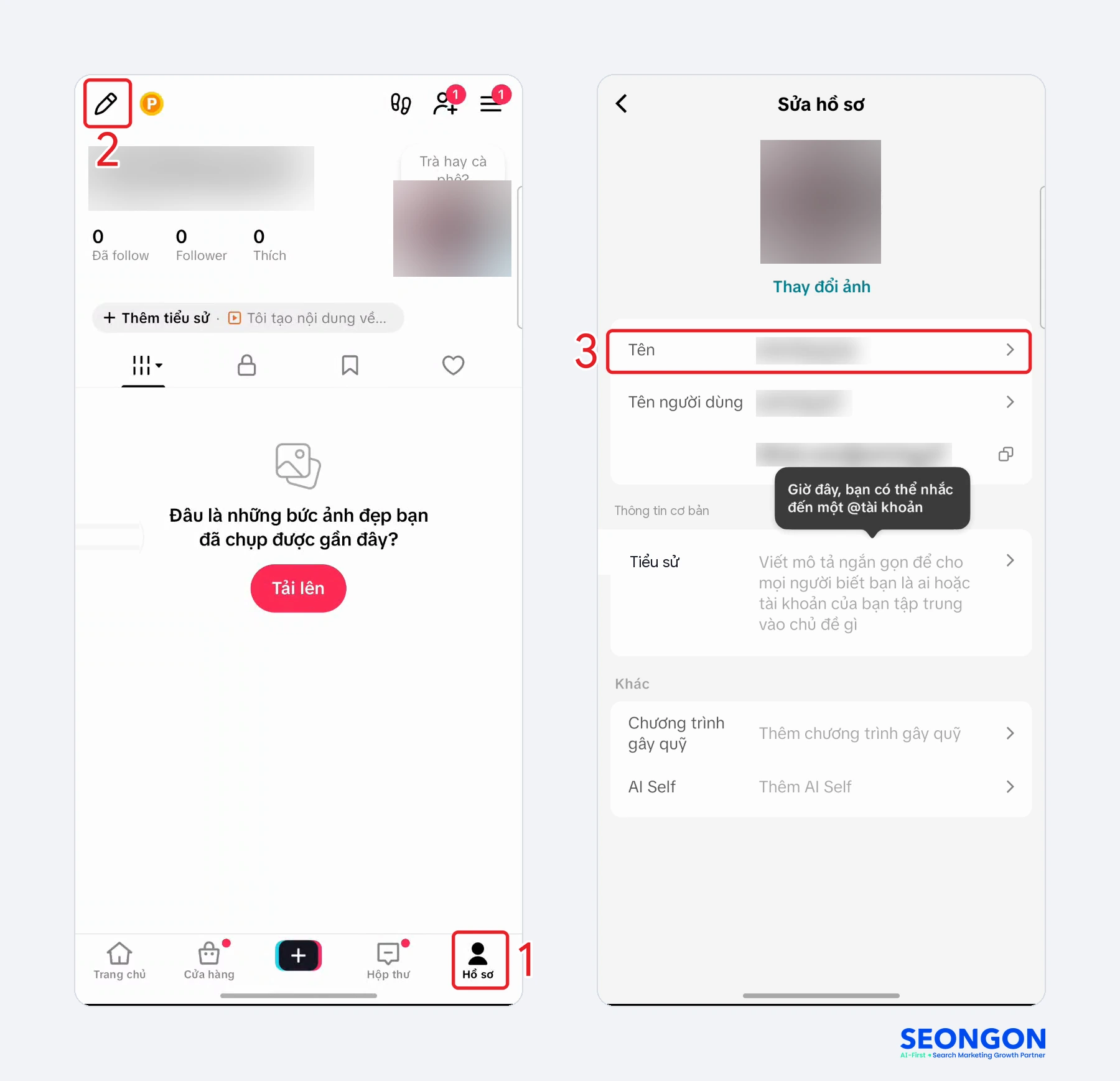 Mở trang Sửa hồ sơ trong app TikTok và bấm vào dòng Tên